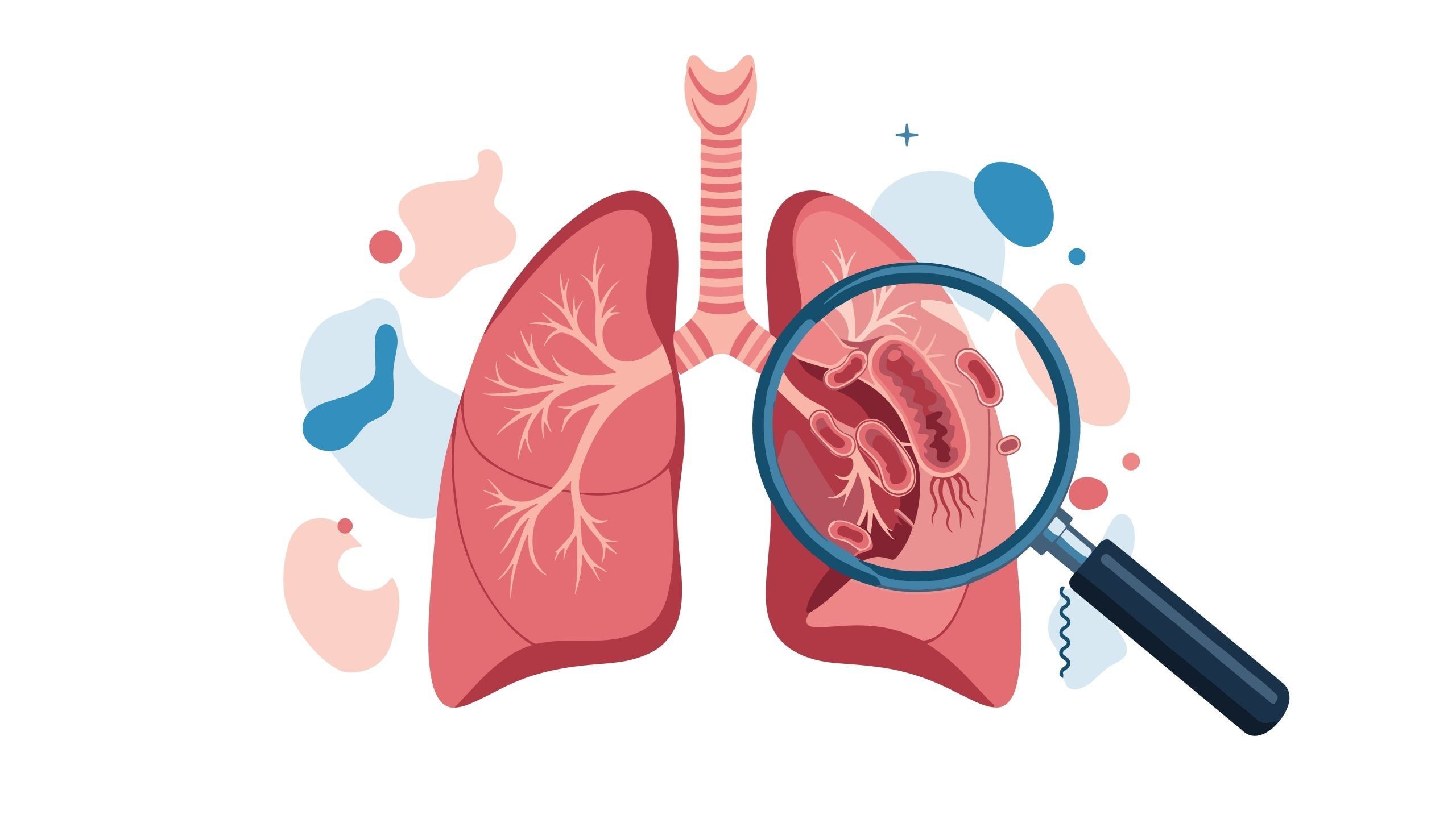 Discover Available Avium Infection Treatment Options for Improved Recovery Support