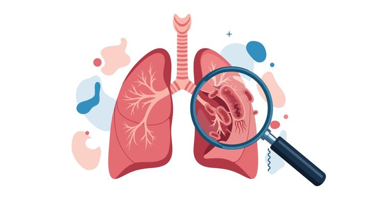 Discover Available Avium Infection Treatment Options for Improved Recovery Support